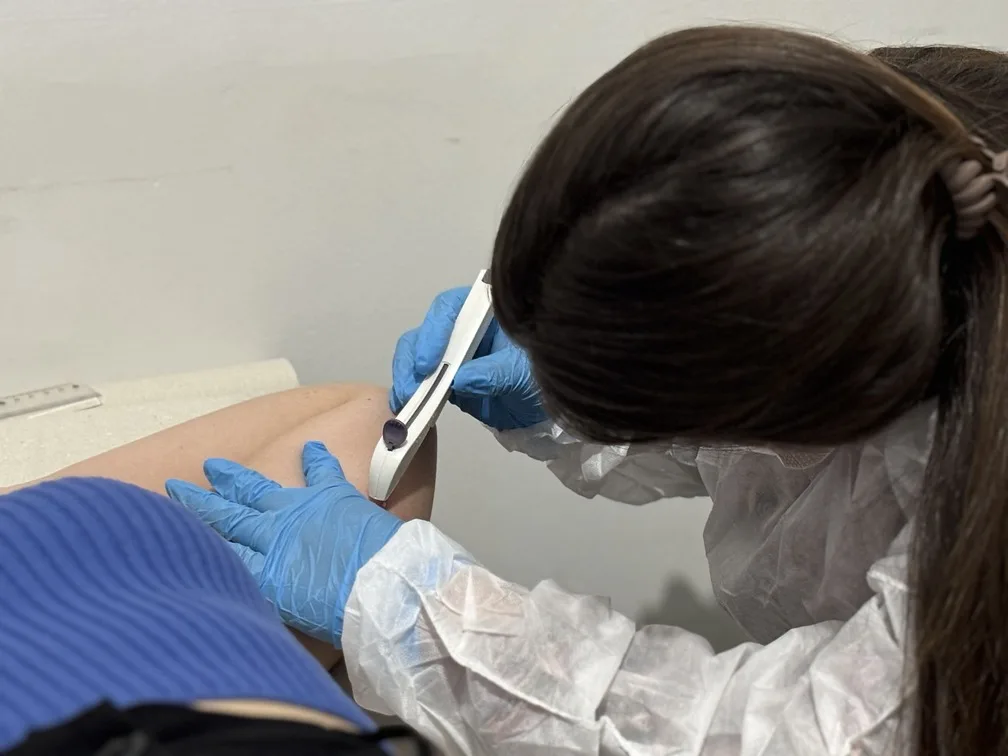 Pinheiros inicia inserção do Implanon pelo SUS para ampliar saúde reprodutiva